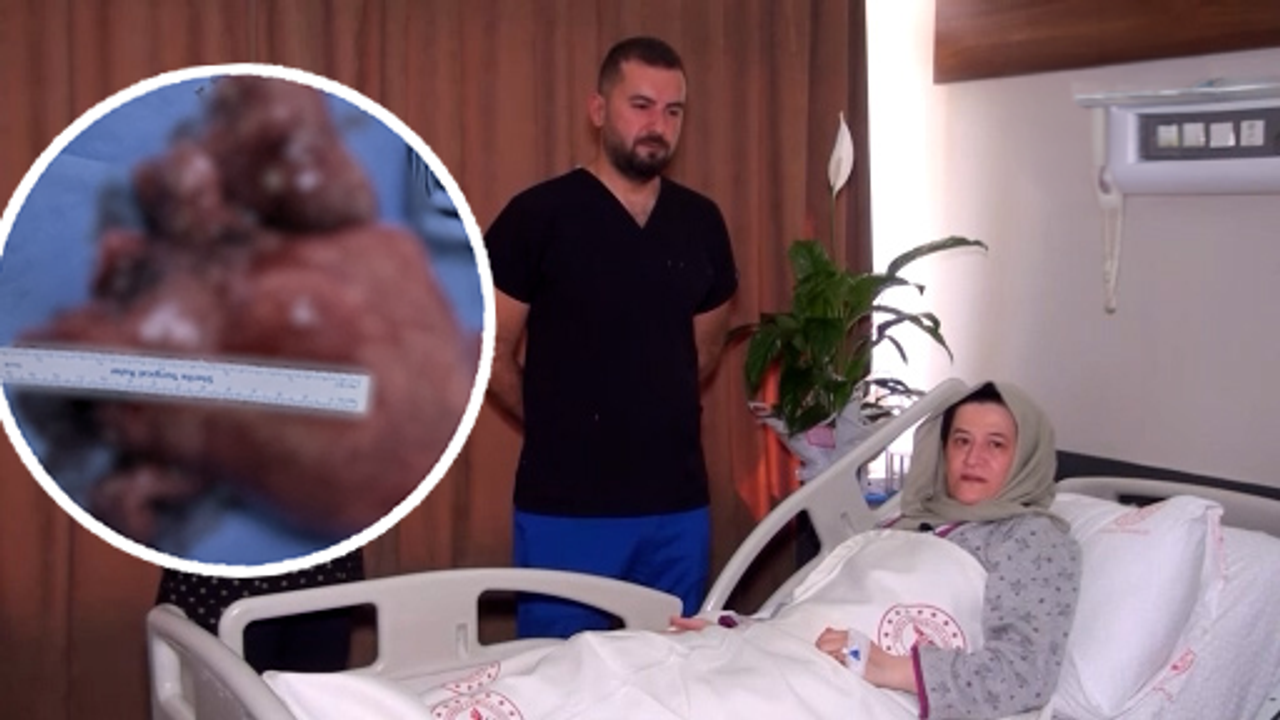 Karnından çıkana inanamadı! Şanlıurfa'da şaşırtan olay