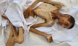 Zulüm İsrail ile başladı! Adil Fevzi Madi ölmeden önce 15 kiloya düştü
