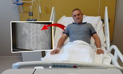 Vücudundan çıkanları görenler şaştı kaldı! 100'e yakın...