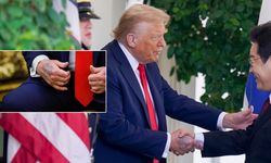 Trump elindeki morlukların sebebini açıkladı!