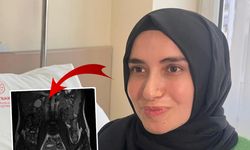 Doktorlar ve tüm dünya şaşkın! Genç kadının vücudundan bakın ne çıktı
