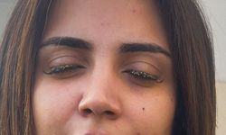 Güzellik merkezinde korku dolu anlar! “Kör olabilirdim…”