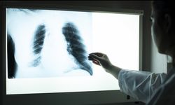 Sigara içenler dikkat! Uzman isim uyardı