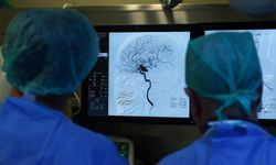 Ünlü oyuncunun beyni bağışlanacak