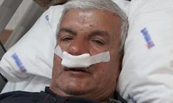 Burun tıkanıklığı sebebi şaşkına çevirdi