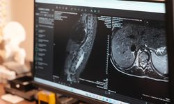 Sinsi sinsi ilerliyor! Ciddi sağlık sorunlarına yol açıyor