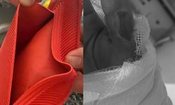 Sıcak su torbası kabusu oldu! Vücudunun yüzde 25’i yandı