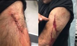 Sokak ortasında öğretmene jiletli saldırı