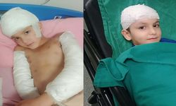 Sokak köpekleri saldırmıştı! Aileye görülmemiş tazminat