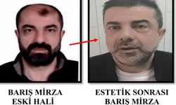 Film değil gerçek! Ameliyatla kardeşinin yüzünü kopyaladı, firari yakalandı