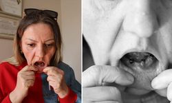 Diş ağrısıyla gitti, kabusu yaşadı! Tam 25 dişi birden çekildi