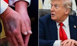 "ABD Başkanı Trump hastaneye kaldırıldı" iddiası...