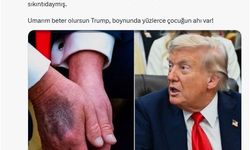 "ABD Başkanı Trump hastaneye kaldırıldı" iddiası...