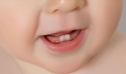 Bebeklerde diş çıkarma annenin gebelik hormonlarıyla ilişkili