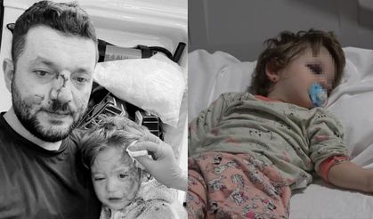 Kızıyla birlikte darp edilen babadan Bakan Gürlek'e teşekkür