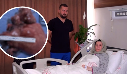 Karnından çıkana inanamadı! Şanlıurfa'da şaşırtan olay
