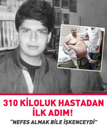 310 kiloluk hastadan ilk adım! “Nefes almak bile işkenceydi”