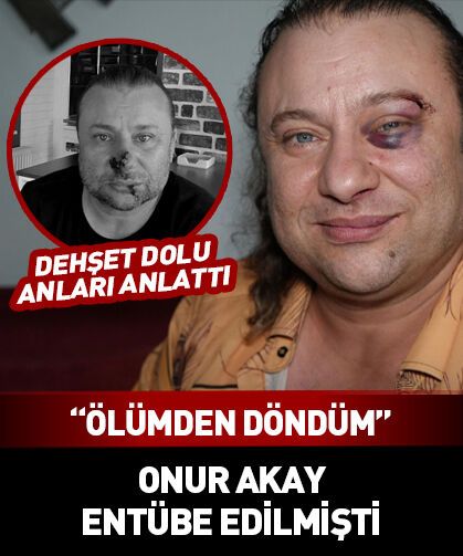Pitbull saldırısına uğramış, entübe edilmişti! Onur Akay yaşadığı korku dolu anları anlattı