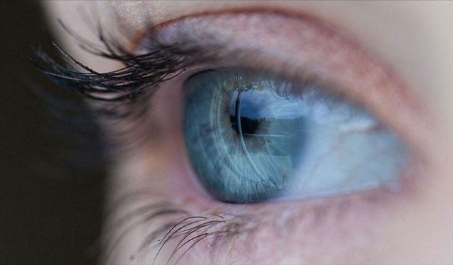 Lens kullananlar dikkat! Uzman isim ‘enfeksiyon riski’ diyerek uyardı