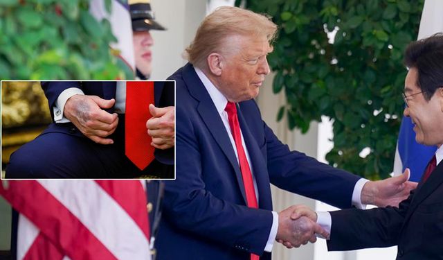 Trump elindeki morlukların sebebini açıkladı!