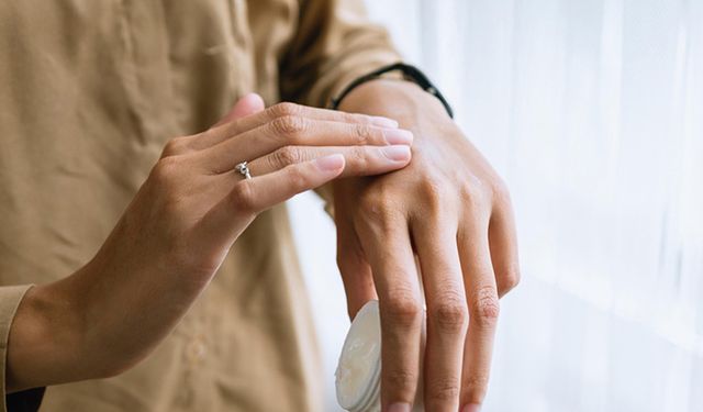 "Mucize ürünlere" dikkat! Cilt sorunlarına sebep olabilir