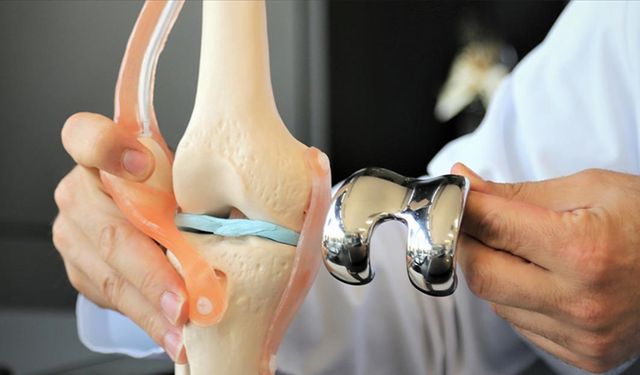 Türk bilim insanları keşfetti! Diz kireçlenmesini hafifletiyor