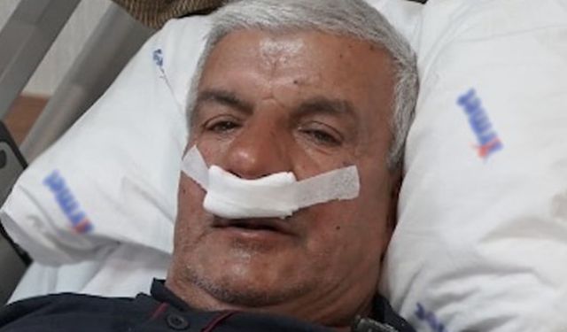 Burun tıkanıklığı sebebi şaşkına çevirdi