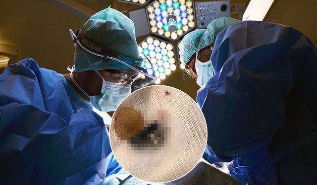 1,5 yaşındaki bebeğin yuttuğu cisim bağırsaklarını deldi!