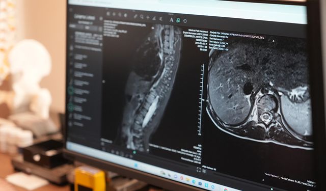 Sinsi sinsi ilerliyor! Ciddi sağlık sorunlarına yol açıyor