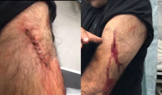 Sokak ortasında öğretmene jiletli saldırı