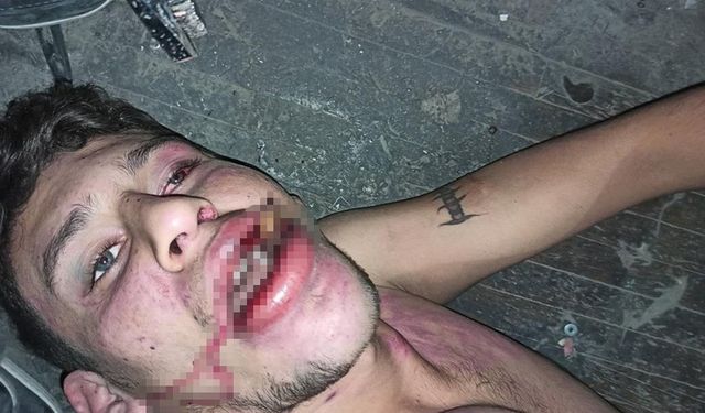 Hamam böceği yedirilerek işkence edilmişti! Yeni gelişme...