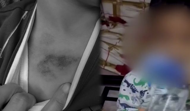 İBB'ye bağlı kreşte şiddet skandalı! Çocuğun ifadesi kan dondurdu