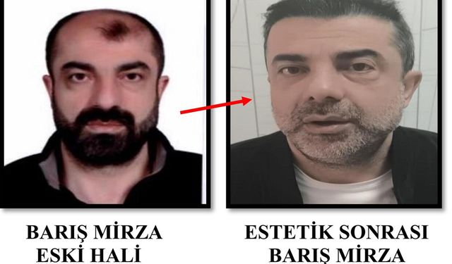 Film değil gerçek! Ameliyatla kardeşinin yüzünü kopyaladı, firari yakalandı