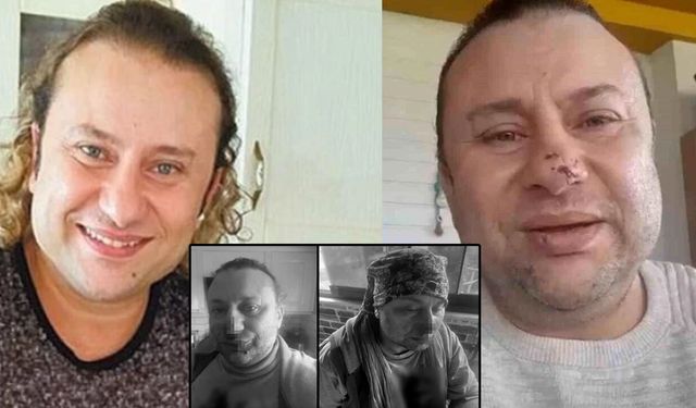 Pitbull saldırısına uğramış, entübe edilmişti! Onur Akay yaşadığı korku dolu anları anlattı