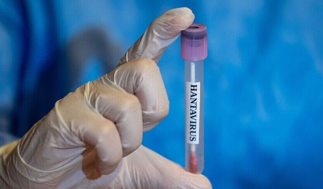 3 Türk vatandaşın Hantavirüs test sonucu belli oldu