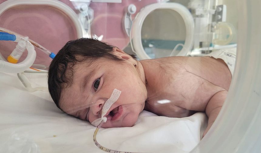34 haftalık bebekten 445 gram tümör çıkarıldı