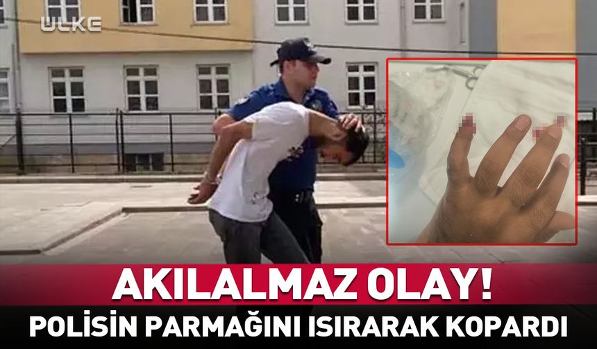 Tekirdağ'da akılalmaz olay! Polisin parmağını ısırarak kopardı