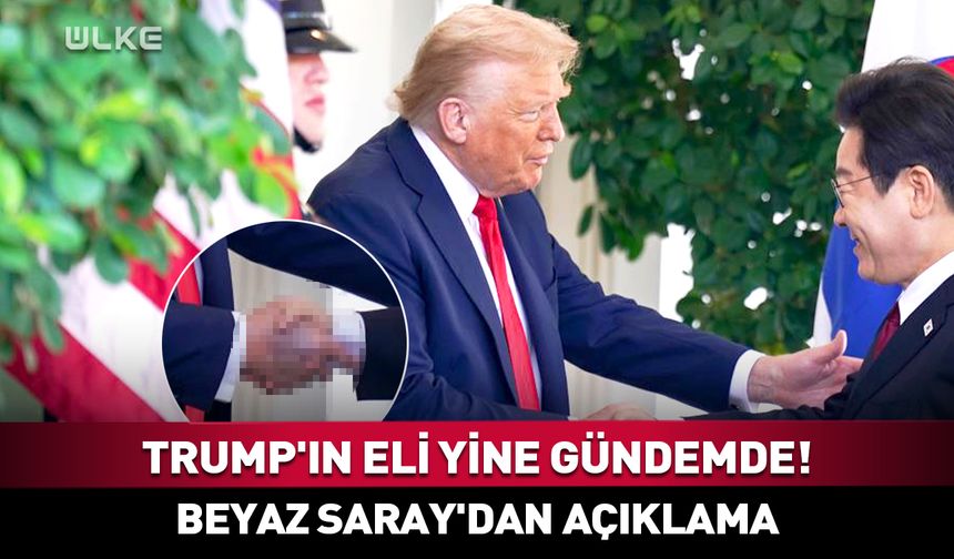 Trump'ın elindeki morluk yine gündemde! Beyaz Saray'dan açıklama
