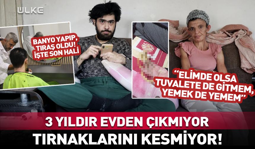 3 yıldır evden çıkmıyor, tırnaklarını kesmiyor!