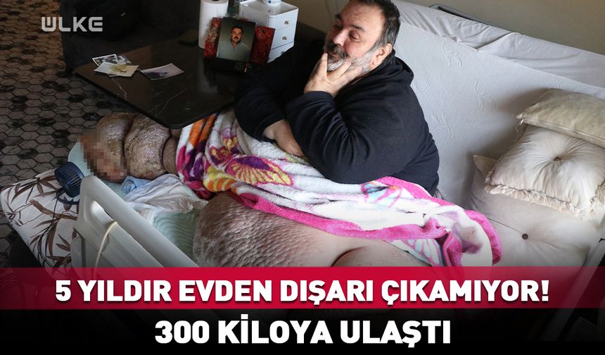 5 yıldır evden dışarı çıkamıyor! 300 kiloya ulaştı