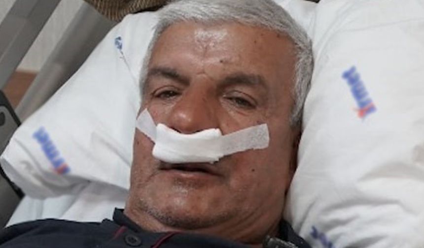 Burun tıkanıklığı sebebi şaşkına çevirdi