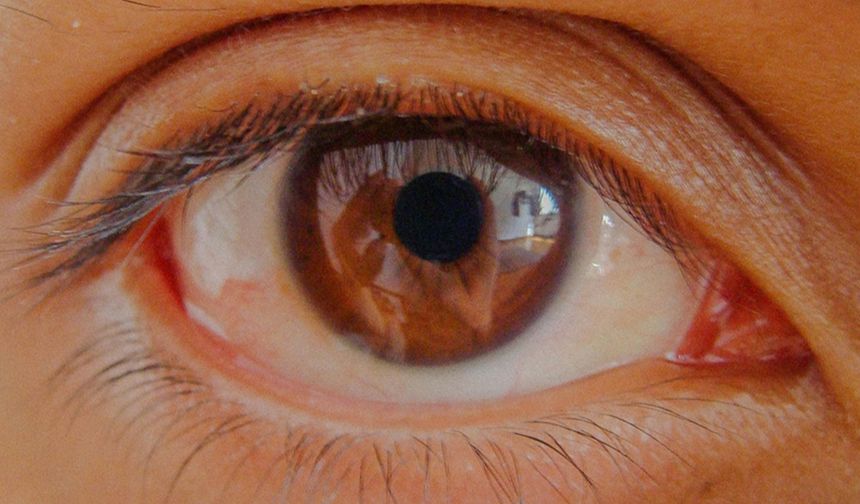 Göz tansiyonunda erken teşhisin önemi