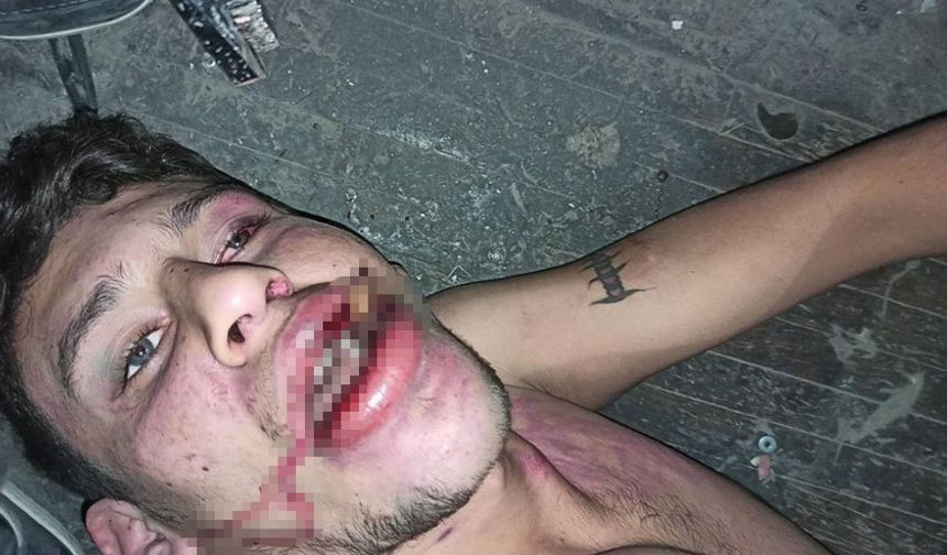 Hamam böceği yedirilerek işkence edilmişti! Yeni gelişme...