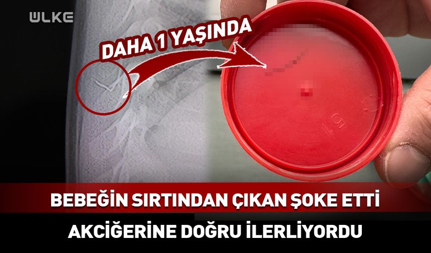 Sürekli ağlıyordu: Bebeğin sırtından çıkan şoke etti