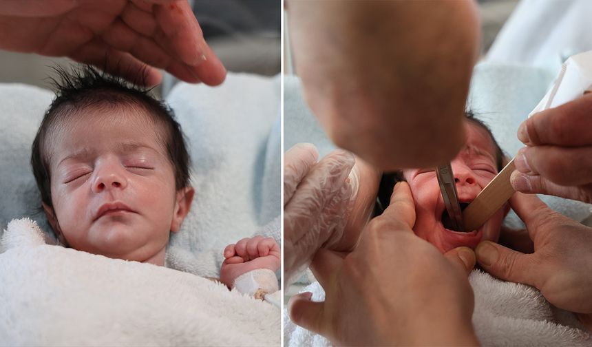 Doğuştan yemek borusu olmayan bebek hayata tutundu