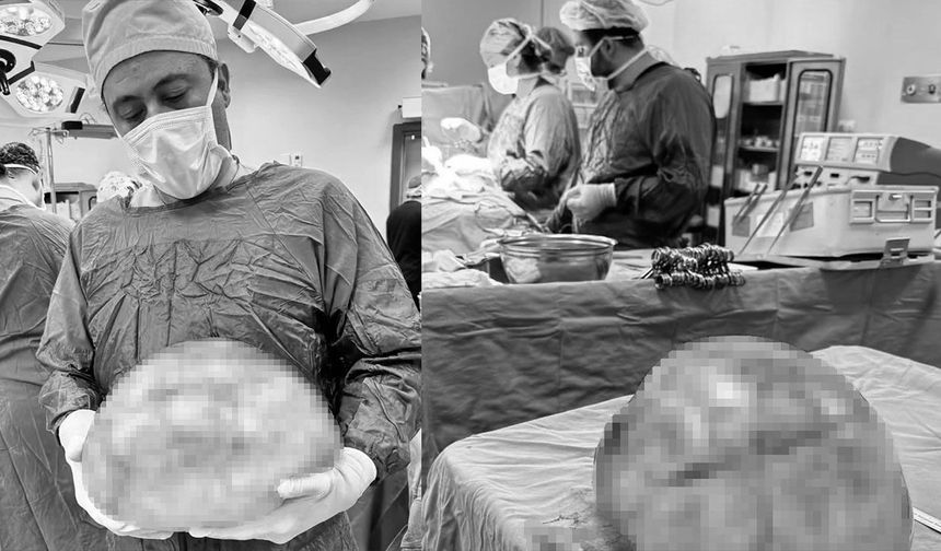 Görenleri hayrete düşürdü! Karnından tam 35 santimetrelik kitle çıktı