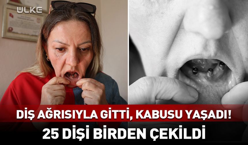 Diş ağrısıyla gitti, kabusu yaşadı! Tam 25 dişi birden çekildi