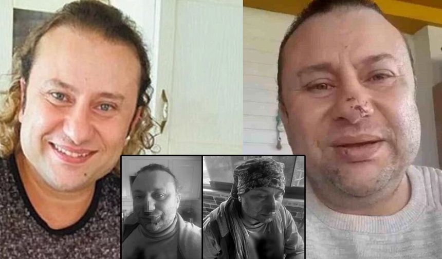 Pitbull saldırısına uğramış, entübe edilmişti! Onur Akay yaşadığı korku dolu anları anlattı