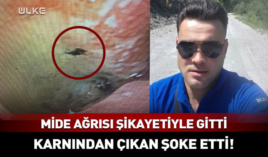 Mide ağrısı şikayetiyle gitti, karnından çıkan şoke etti!