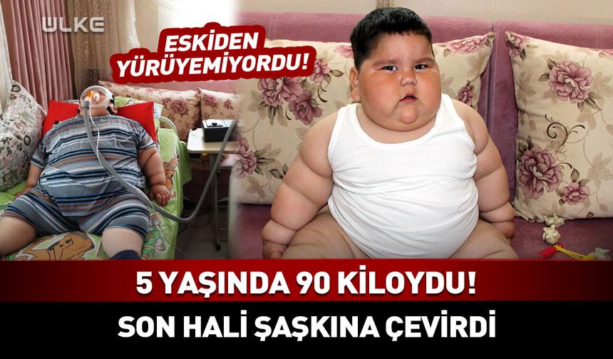 5 yaşında 90 kiloydu! Değişimi herkesi şaşkına çevirdi